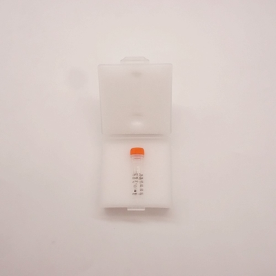 Réactif d'hybridation in situ par fluorescence CBFB Sonde de rupture bicolore